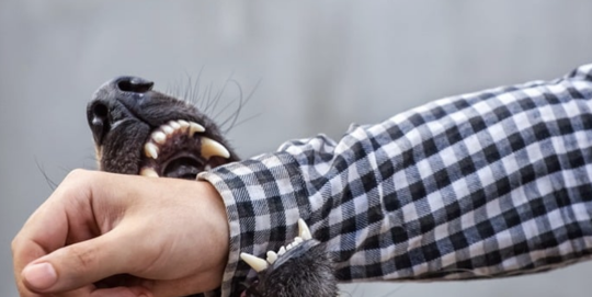 Dog Bites